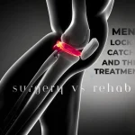 Meniscus Tear: Locking vs Catching & Best Treatment (Surgery vs Rehab) Text on the image and there is a gray style leg bone anatomy which emphasize on Meniscus by highlighting it in red color
