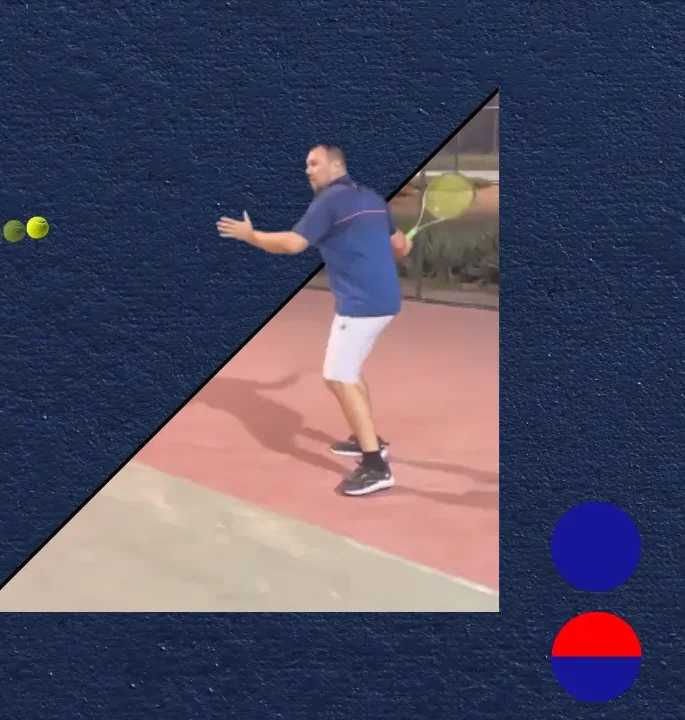 Tennis Elbow Symptoms, Treatment, Recovery Time, and When to Worry by Dr Tomislav Orthopedic Surgeon Dubai UAE