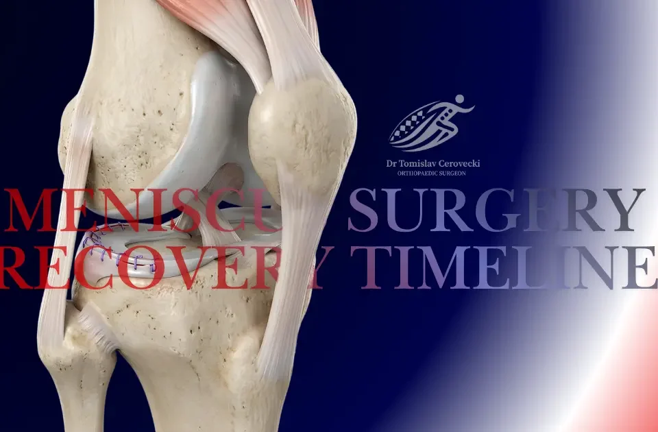 Meniscus surgery recovery timeline banner showing a repaired meniscus in a 3D knee model