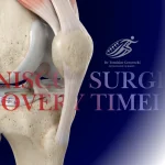 3D knee anatomy illustration showing a sutured meniscus repair for a blog about meniscus surgery recovery timeline by Dr Tomislav Cerovecki.