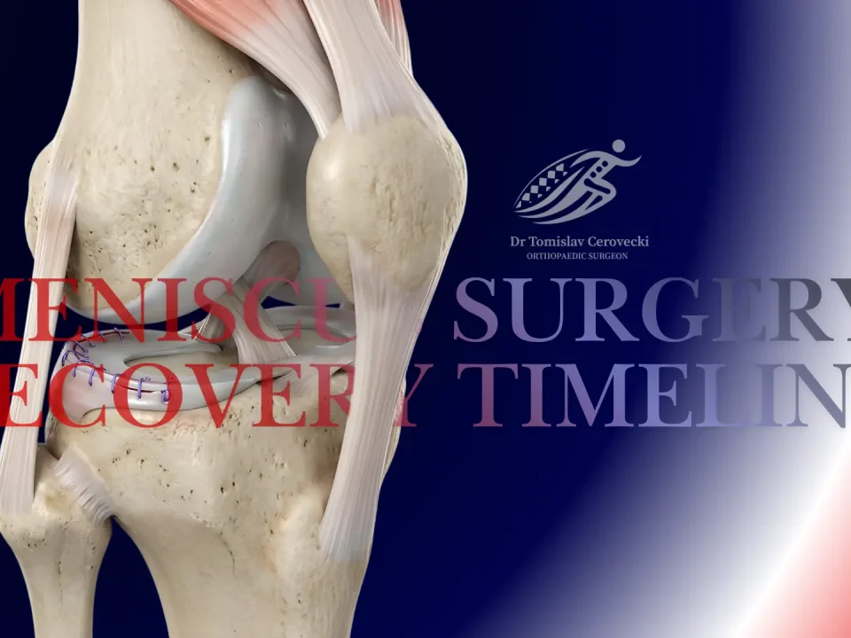 3D knee anatomy illustration showing a sutured meniscus repair for a blog about meniscus surgery recovery timeline by Dr Tomislav Cerovecki.