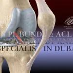 ACL Tear Symptoms, AM & PL Bundles, and Treatment in Dubai