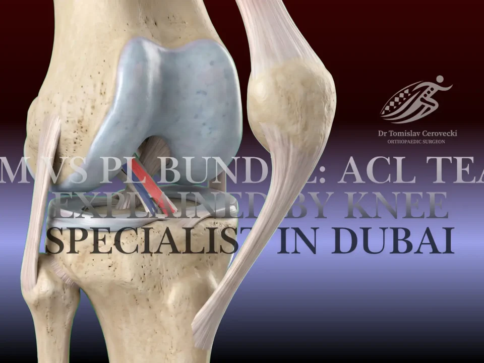 ACL Tear Symptoms, AM & PL Bundles, and Treatment in Dubai