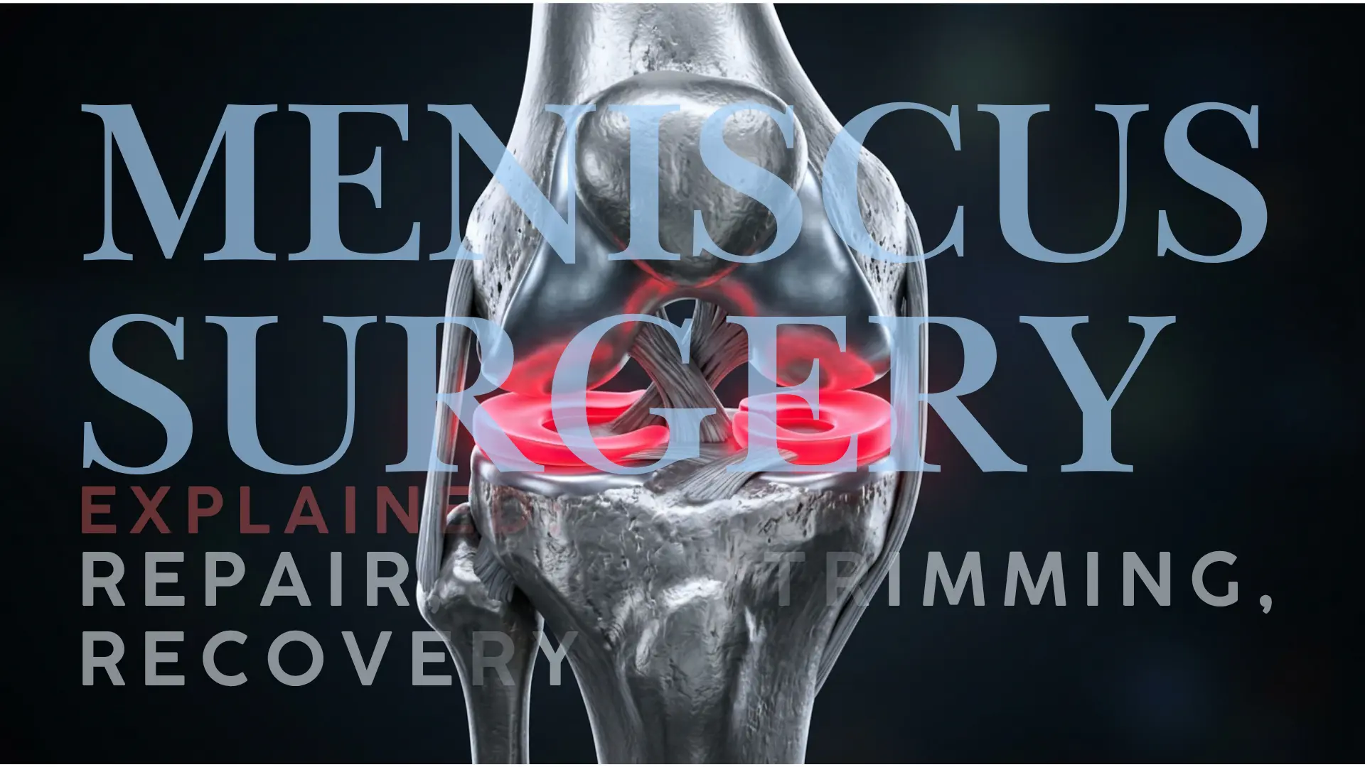 Meniscus surgery explained with metallic knee anatomy and red highlighted meniscus cartilage.
