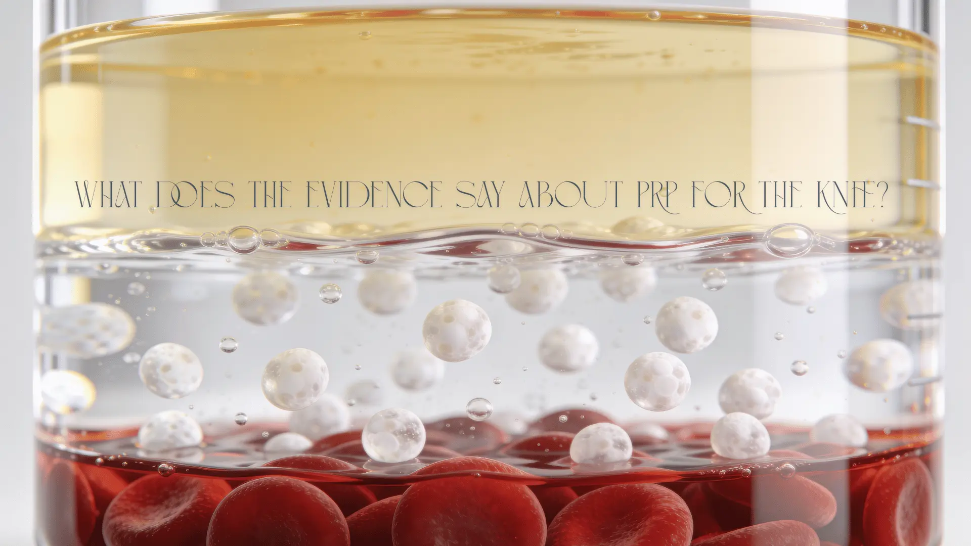 Evidence-informed comparison of PRP and knee injection choices by Dr. Tomislav Cerovecki in Dubai