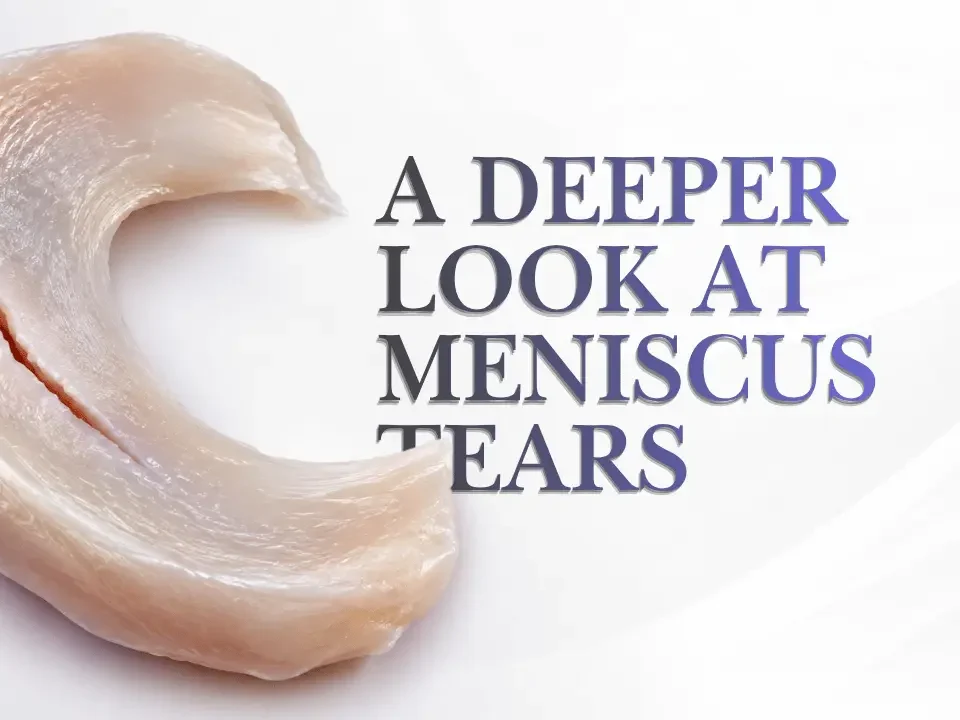 Hyper-realistic close-up of knee meniscus fibrocartilage showing a longitudinal tear along the tissue surface.